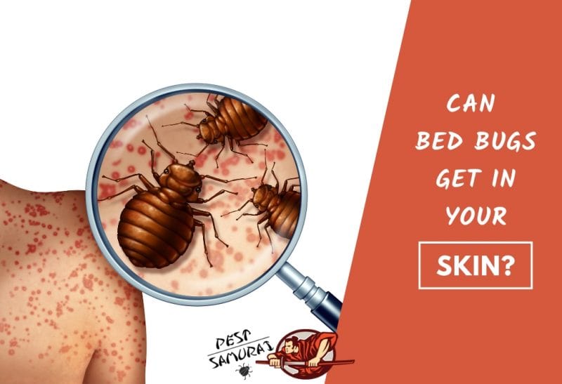 Bed Bugs on Skin Can Bed Bugs Get in Your Skin