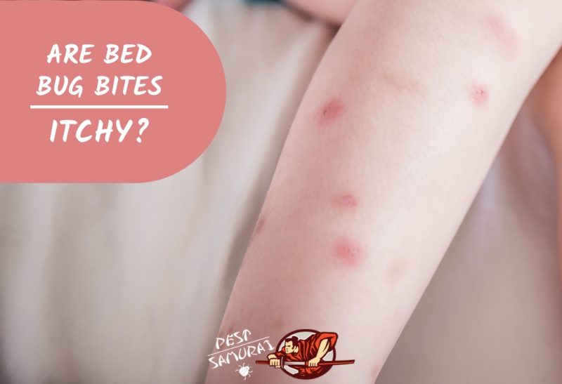 bed bug bites not itchy