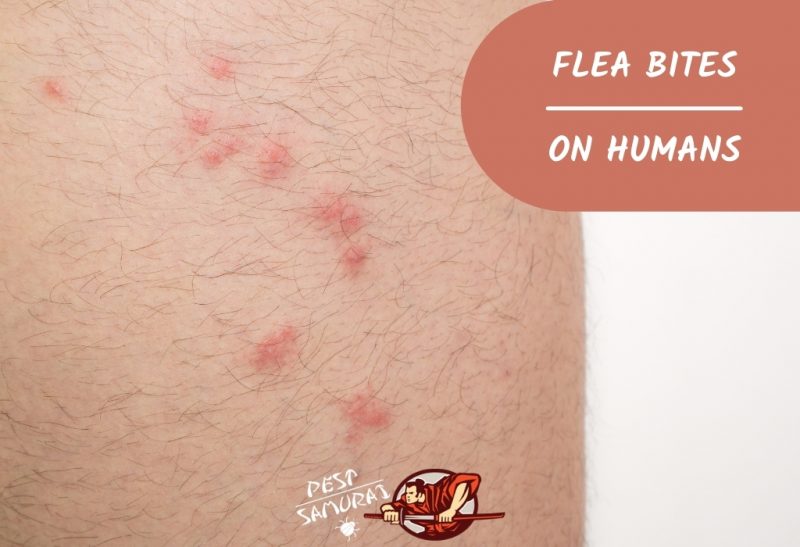 Flea Bites on Humans
