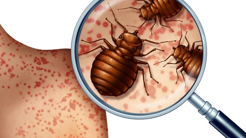 Can Bed Bugs Transfer Diseases