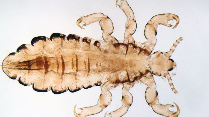 image-of-what-different-bites-skin-conditions-look-like-bed-bug