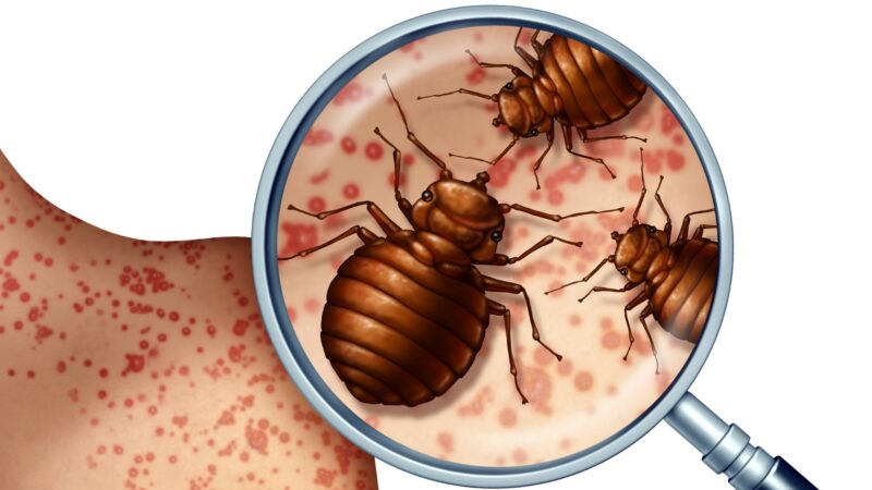 What Part of Your Body Do Bed Bugs and Spiders Bite