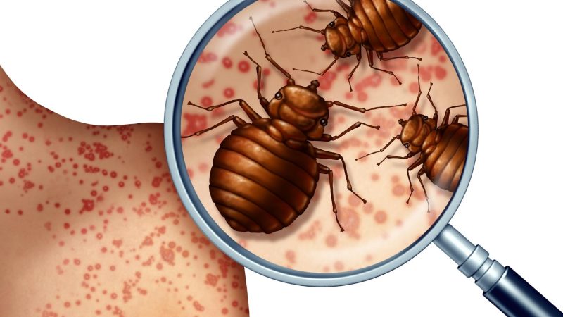 Are Baby Bed Bug Bites Dangerous