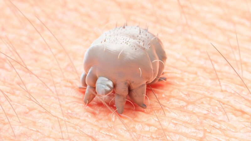 What Are Scabies Mites