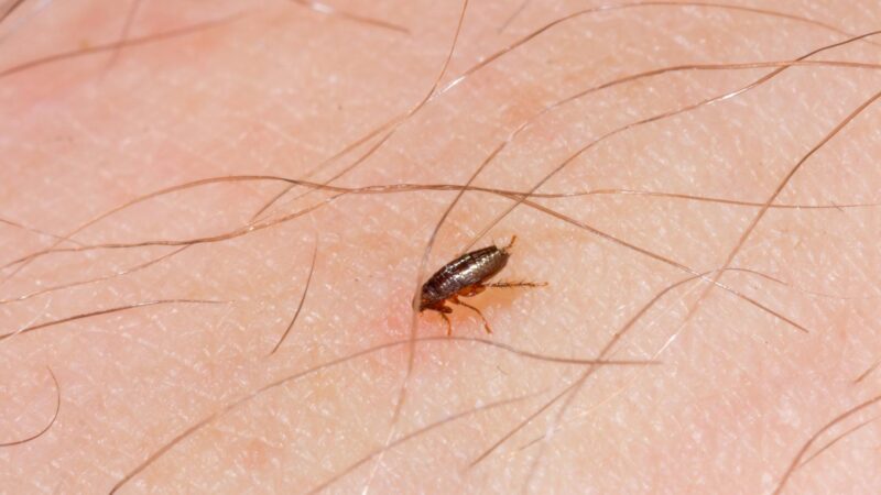 Should You Be Concerned With Flea Bites